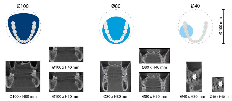 Dijagram veličina polja 3D CBCT snimka: Ø100, Ø80 i Ø40